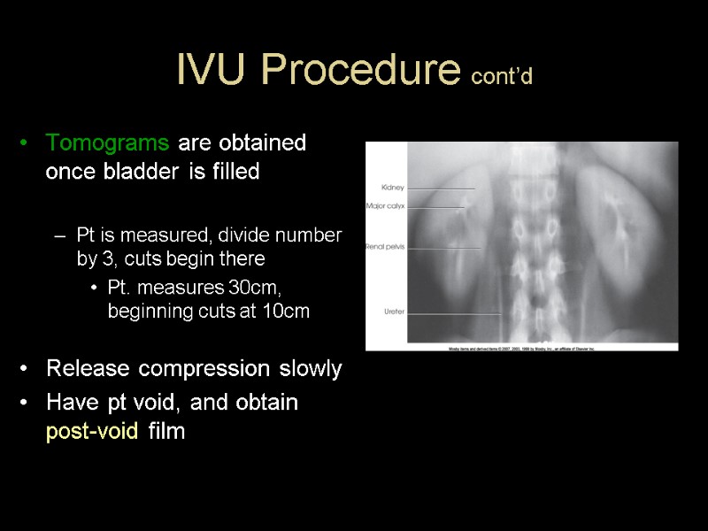 IVU Procedure cont’d Tomograms are obtained once bladder is filled  Pt is measured,